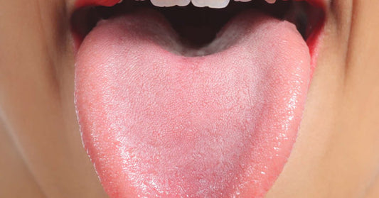 Did You Find Spots on Your Tongue?